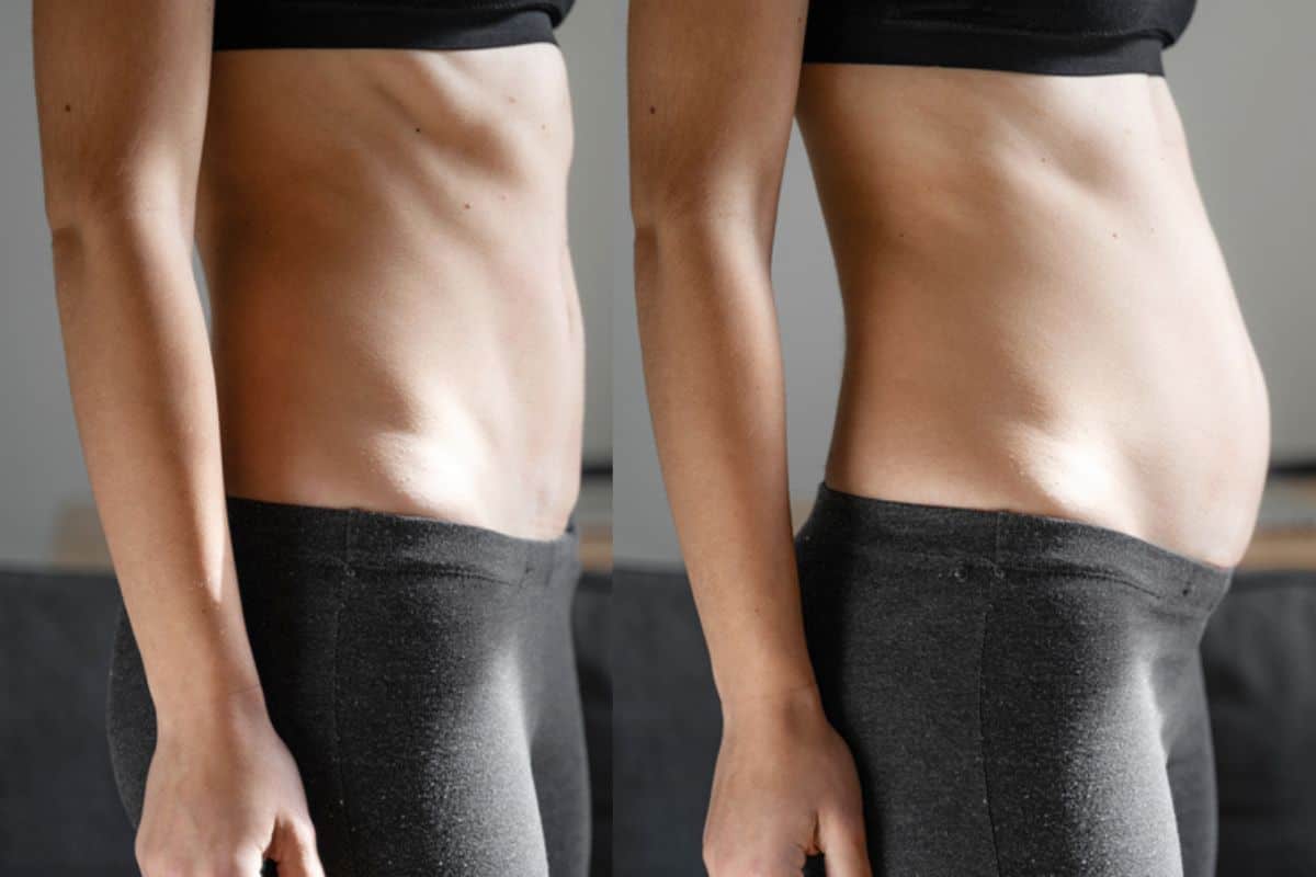 How long does diastasis recti take to improve Oxford?