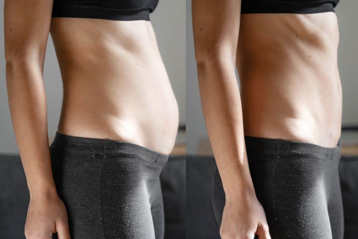 Post-Pregnancy: What Happens to Your Abdominal Muscles After Birth Oxford