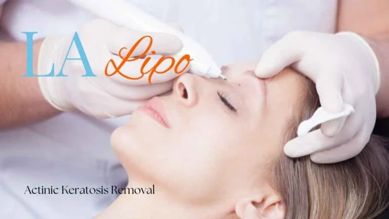Woman receiving Actinic Keratosis Removal Treatment Oxford