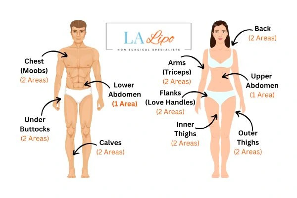 LA LIPO Cryolipolysis Areas Oxford