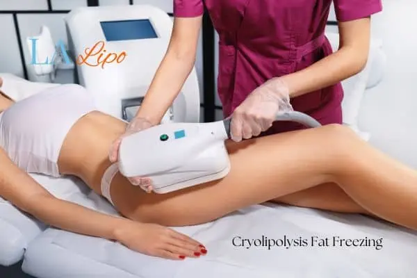 Woman receiving coolsculpting Oxford treatment on her thighs