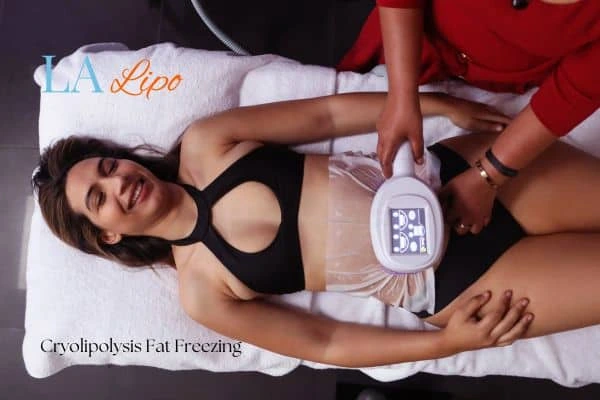 woman getting cryolipolysis Oxford