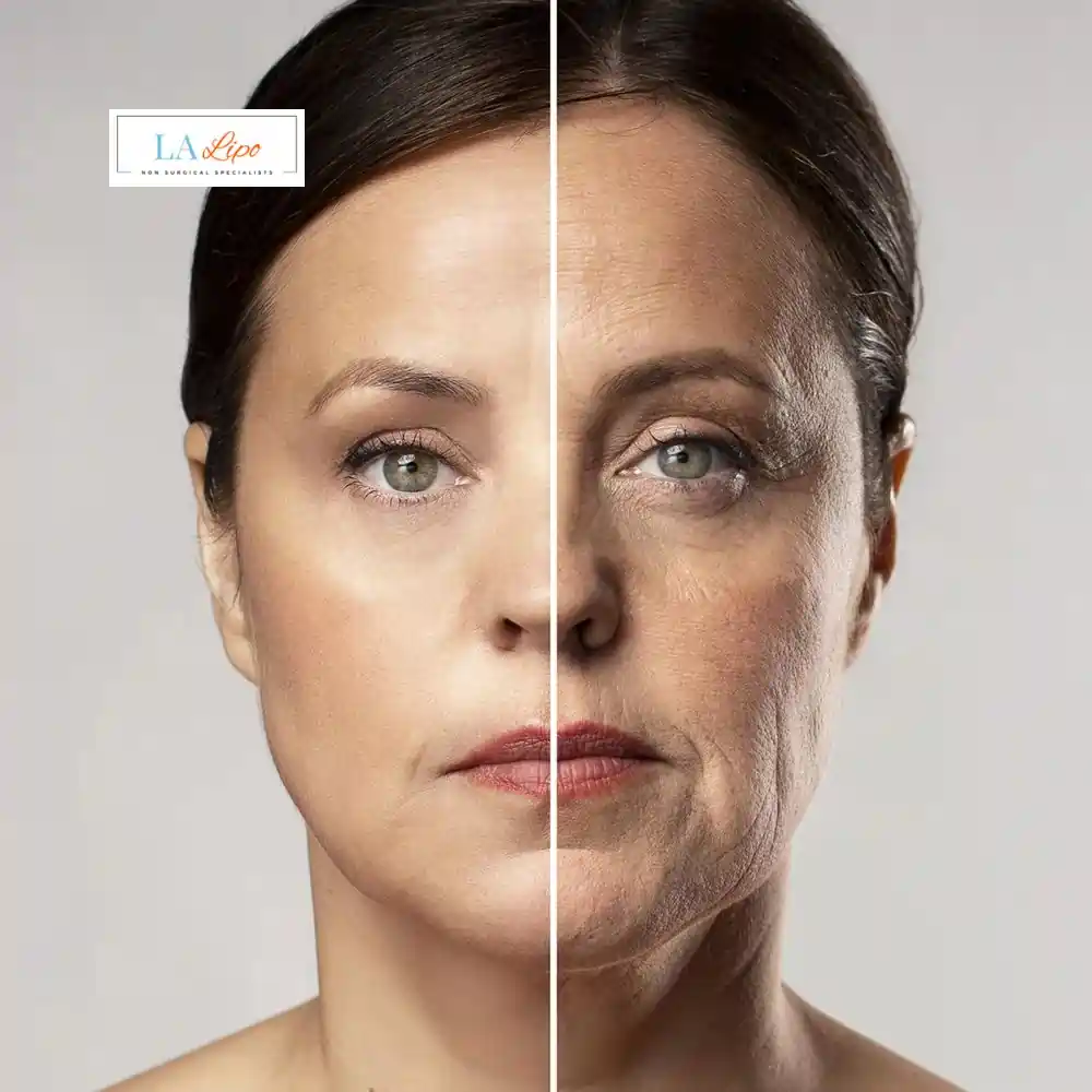 How Can You Tell If Non-Surgical Skin Tightening Is Right for You Oxford?
