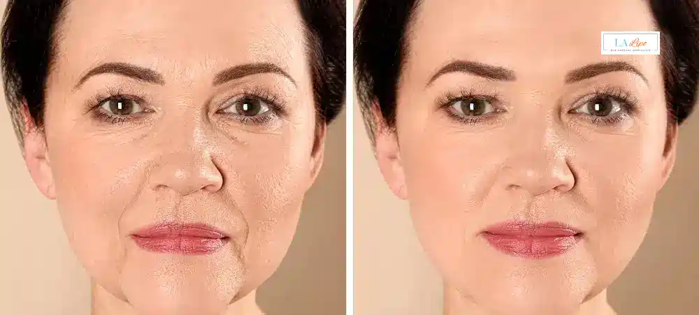 How Long Does It Take to See Results and How Long Do They Last Oxford?