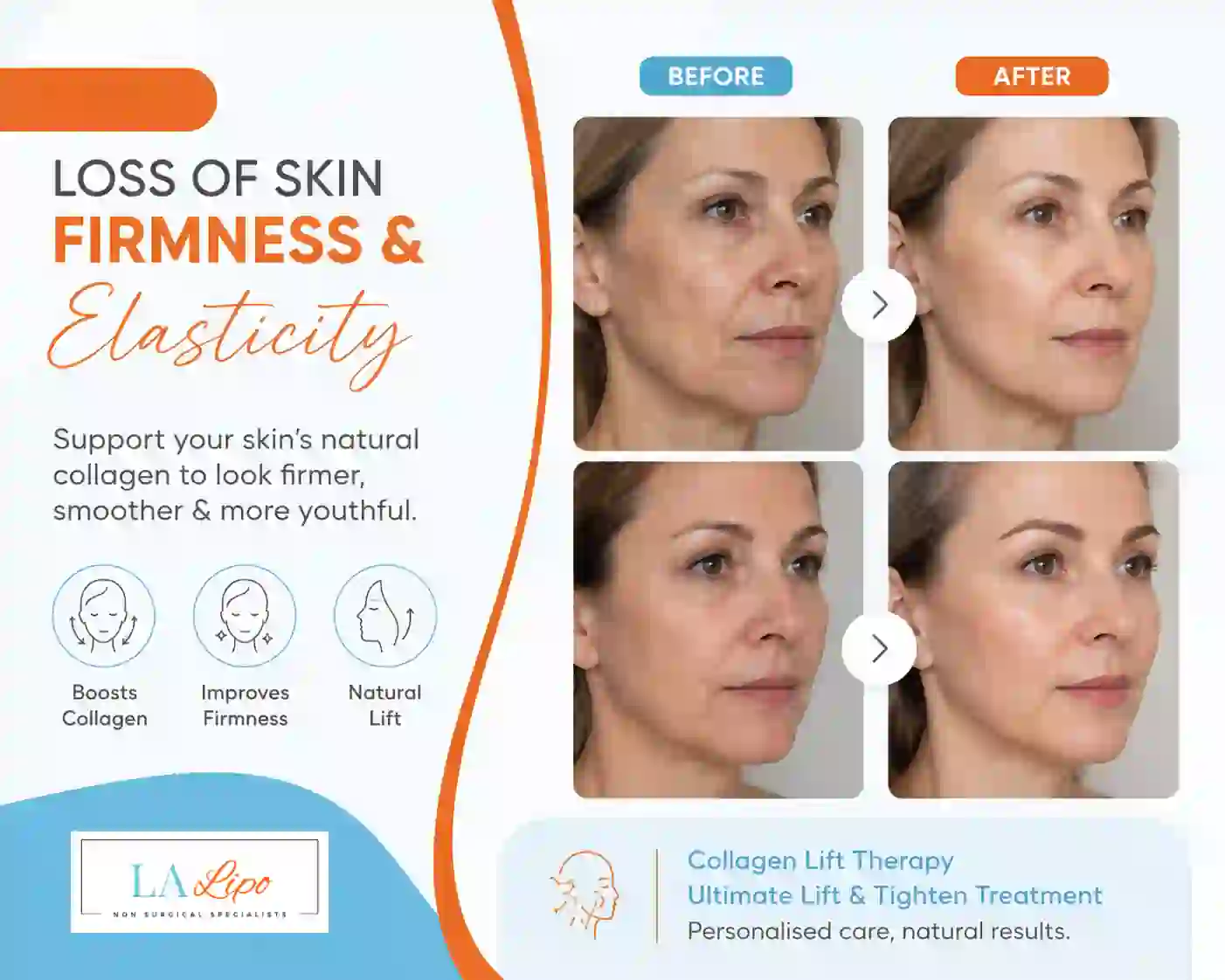 Sign #7: Loss of Skin Firmness and Elasticity Oxford